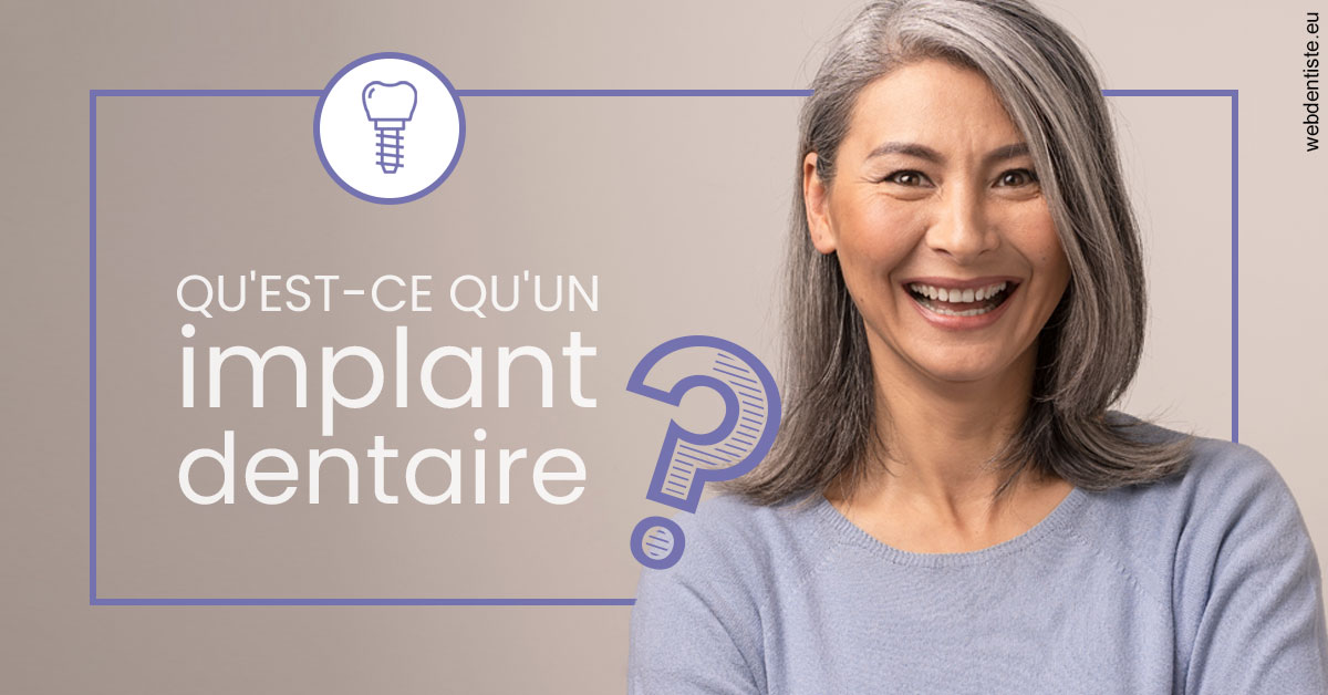 https://www.dr-falanga-henri-jean.fr/Implant dentaire 1