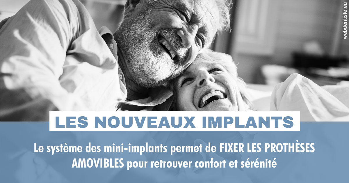 https://www.dr-falanga-henri-jean.fr/Les nouveaux implants 2