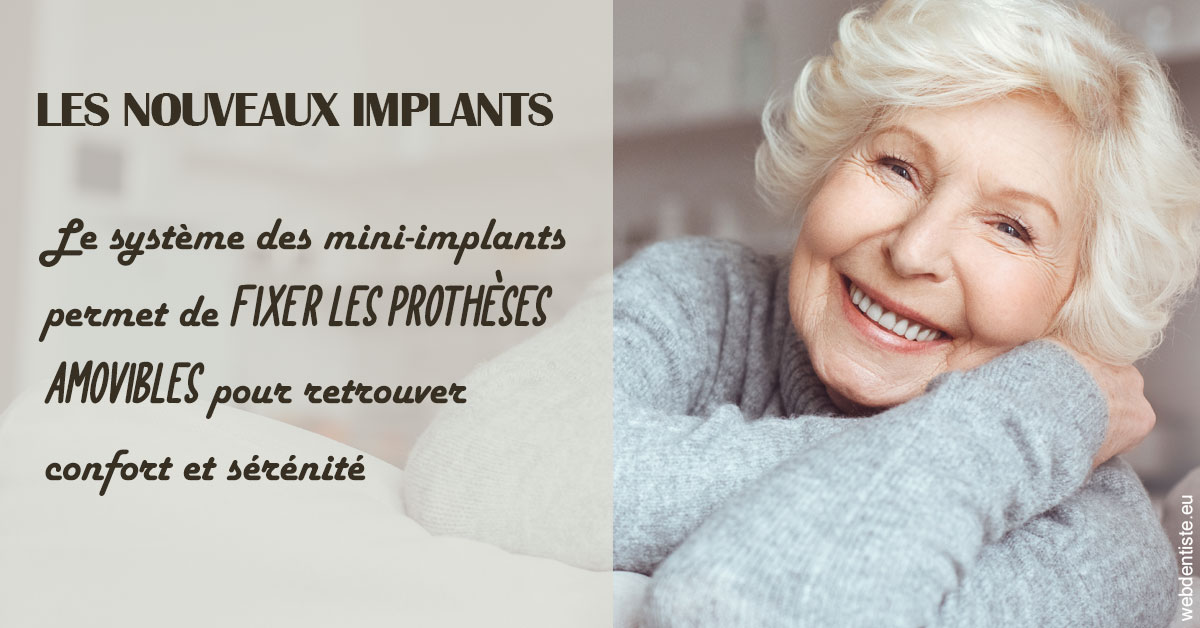 https://www.dr-falanga-henri-jean.fr/Les nouveaux implants 1