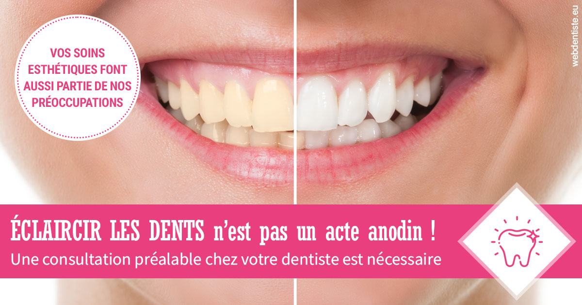 https://www.dr-falanga-henri-jean.fr/2024 T1 - Eclaircir les dents 01