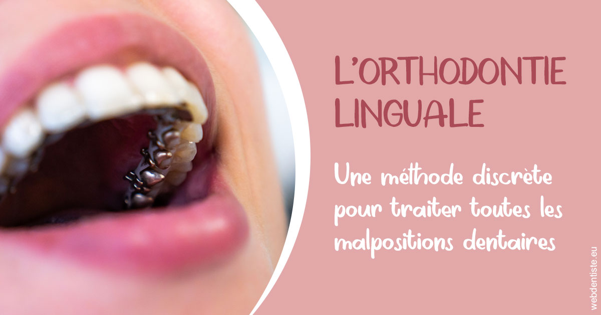 https://www.dr-falanga-henri-jean.fr/L'orthodontie linguale 2