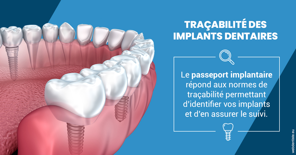 https://www.dr-falanga-henri-jean.fr/T2 2023 - Traçabilité des implants 1