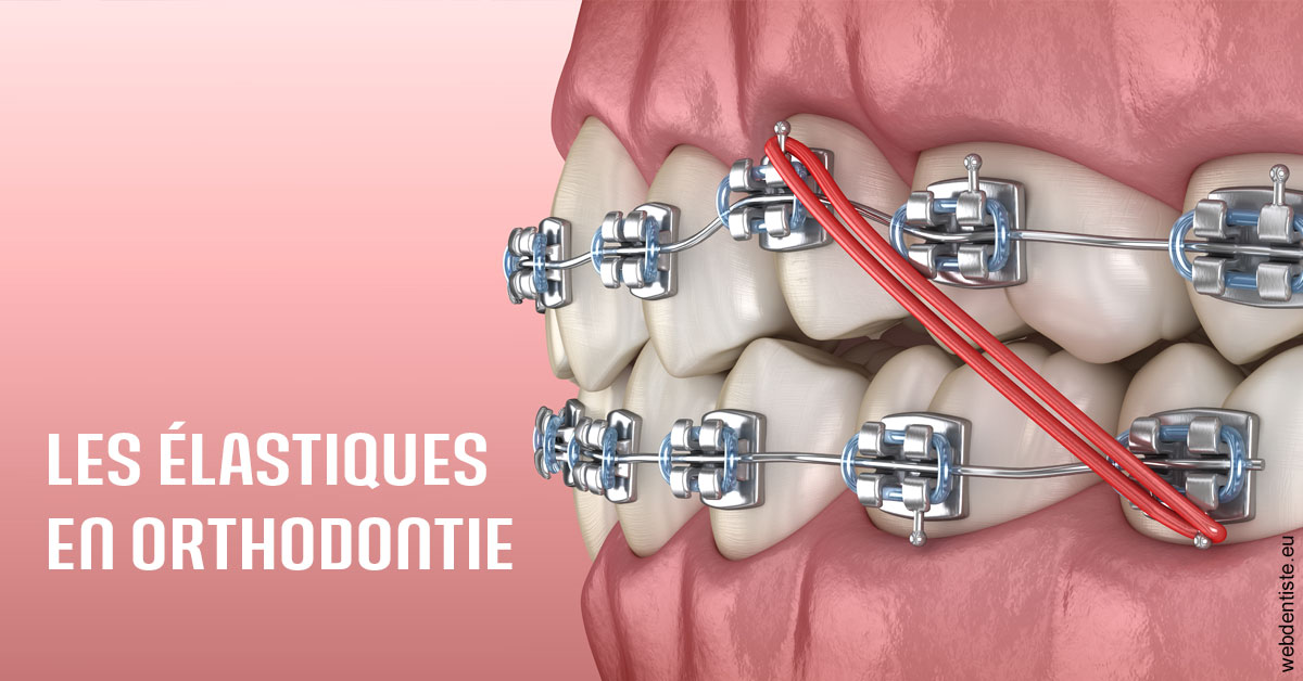 https://www.dr-falanga-henri-jean.fr/Elastiques orthodontie 2