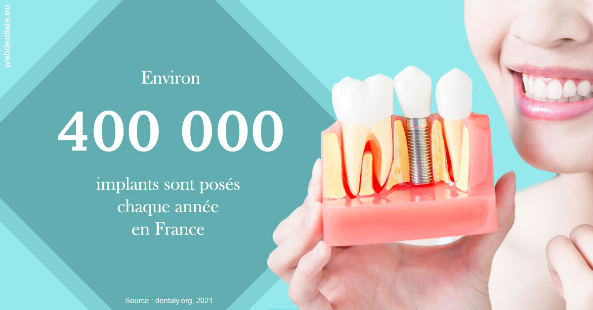 https://www.dr-falanga-henri-jean.fr/Pose d'implants en France 2