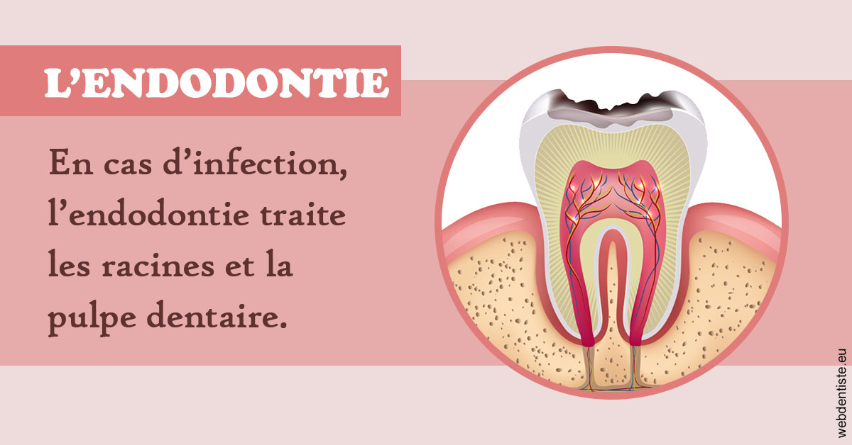https://www.dr-falanga-henri-jean.fr/L'endodontie 2