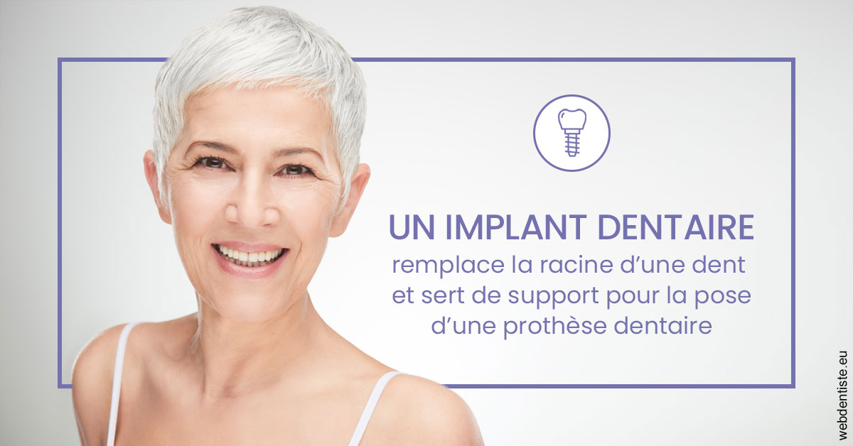 https://www.dr-falanga-henri-jean.fr/Implant dentaire 1