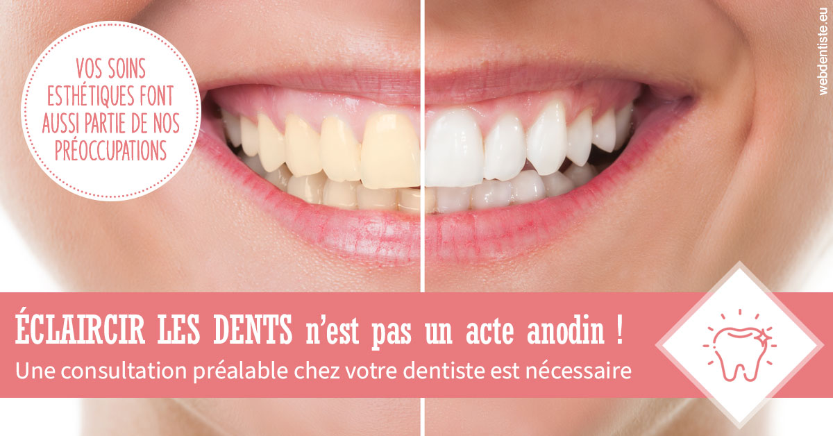 https://www.dr-falanga-henri-jean.fr/Eclaircir les dents 1